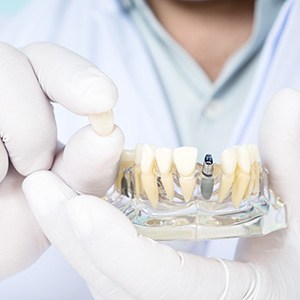 Dentist holding a model of a single dental implant with a crown