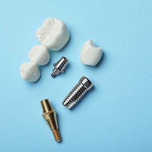 An implant-supported bridge on a table