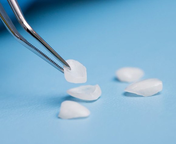 Veneers on a table